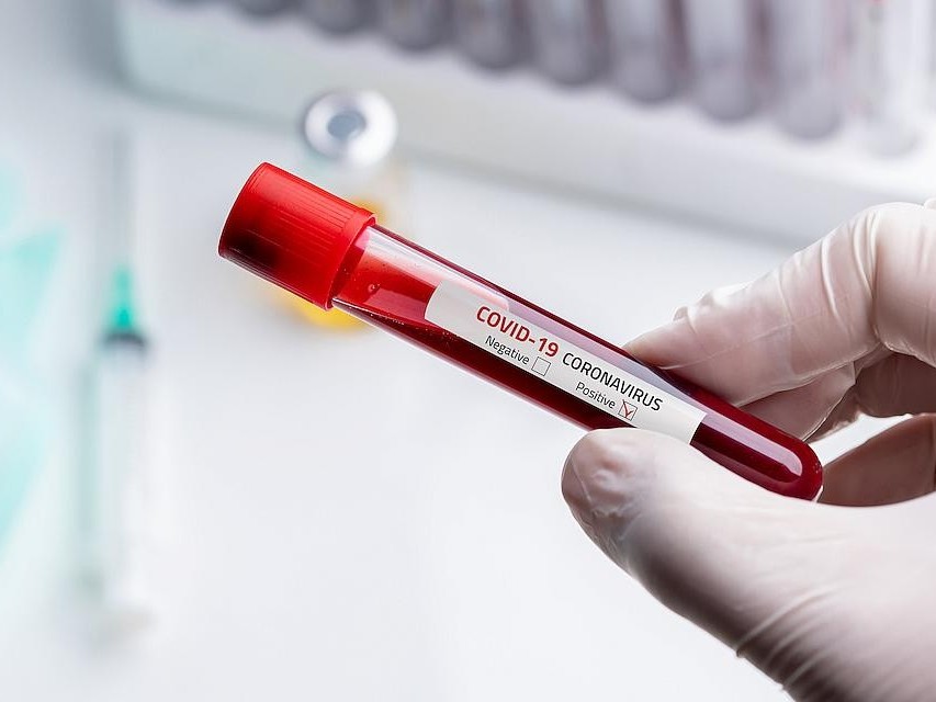 Coronavirus: Uzbekistan confirms 10 cases