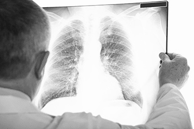 5 new COVID-like pneumonia cases registered in Kazakhstan